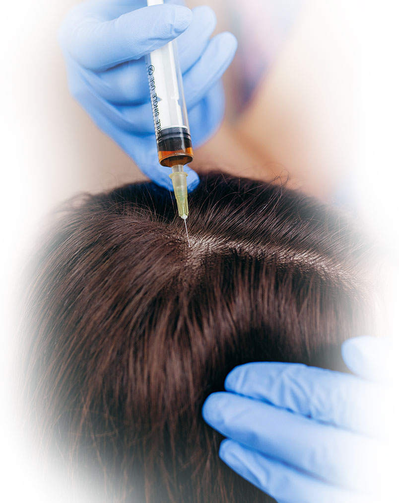 Hair Restoration, Skinsational Medspa, Morgantown, WV